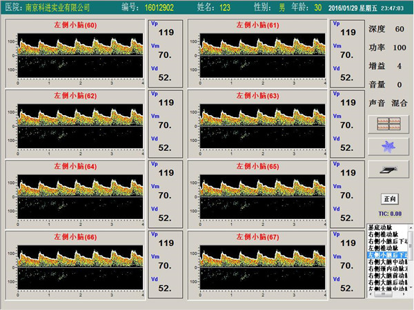 經(jīng)顱多普勒單通道，八深度界面