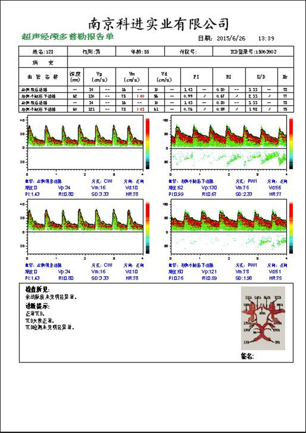 經(jīng)顱多普勒報告圖.jpg