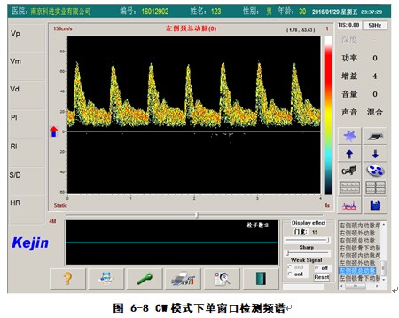 經(jīng)顱多普勒軟件cw模式下檢測(cè)界面.JPG