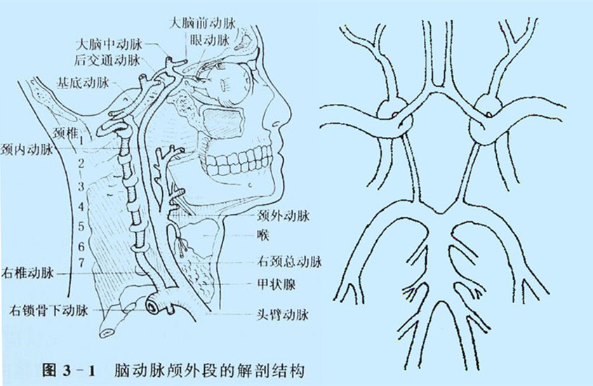 腦動脈顱外段的右側(cè)面圖Willis環(huán)的模擬圖.jpg