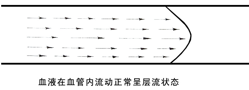 血液在血管內(nèi)流動正常呈層流狀態(tài).jpg