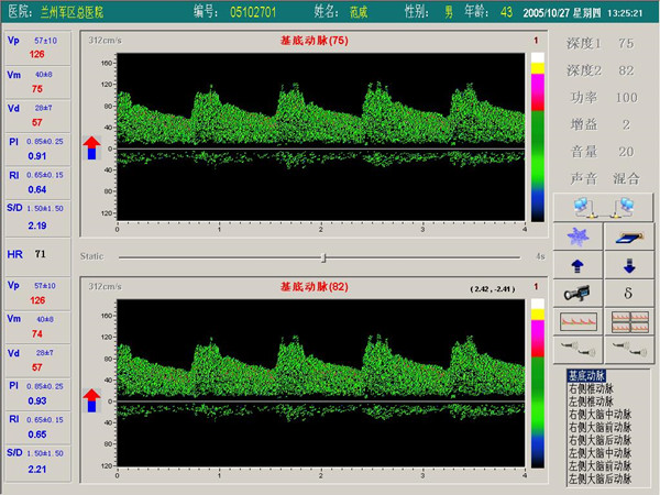 超聲經顱多普勒血流分析儀雙窗口（雙通道或雙深度）檢測界面.jpg
