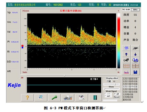 經(jīng)顱多普勒軟件PW模式下單窗口檢測界面