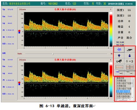 經(jīng)顱多普勒軟件單通道雙深度檢測界面