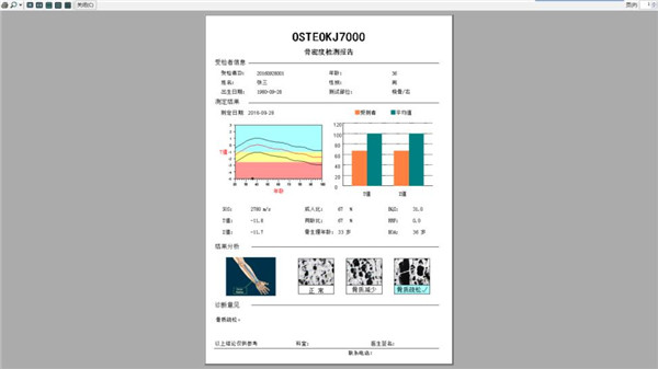 脛骨橈骨骨密度儀報告打印1